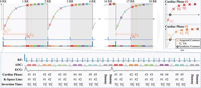 Cardiac phase-resolved late gadolinium enhancement imaging